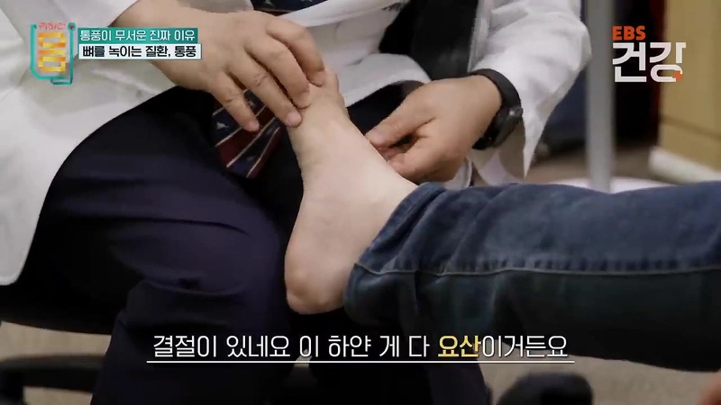 345.mp4_001146.015.jpg 30대 통풍 환자의 발상태 ㄷㄷㄷㄷ...jpg