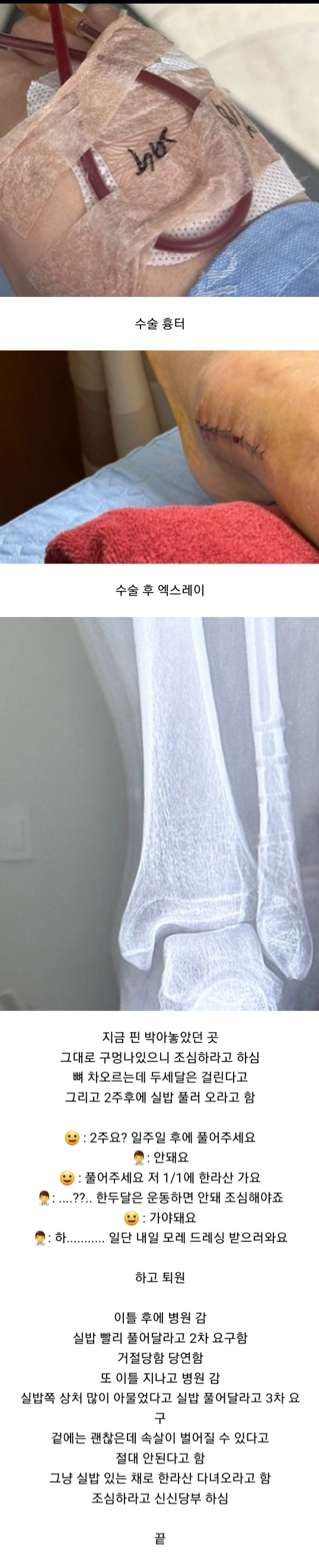 Internet_20231228_235854_5.jpeg 발목 부러졌는데 하나도 안아프다는 여자의 11개월 뒤 근황 ㄷㄷㄷ.JPG