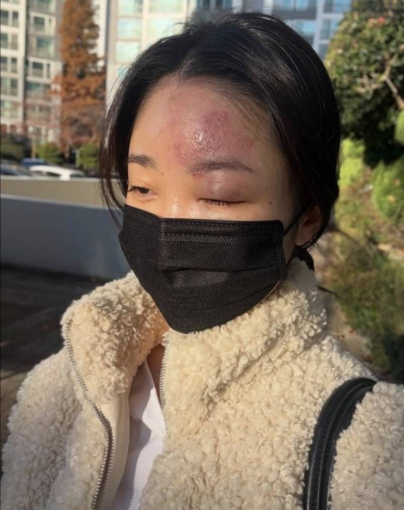 사진주의)현재 스레드에서 난리난 역대급 의료사고.jpg | 인스티즈