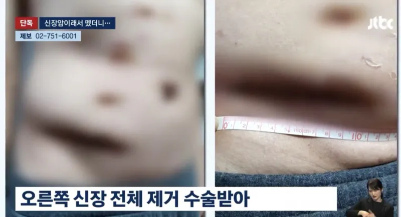 오늘자 커뮤에서 개난리난 역대급 사건