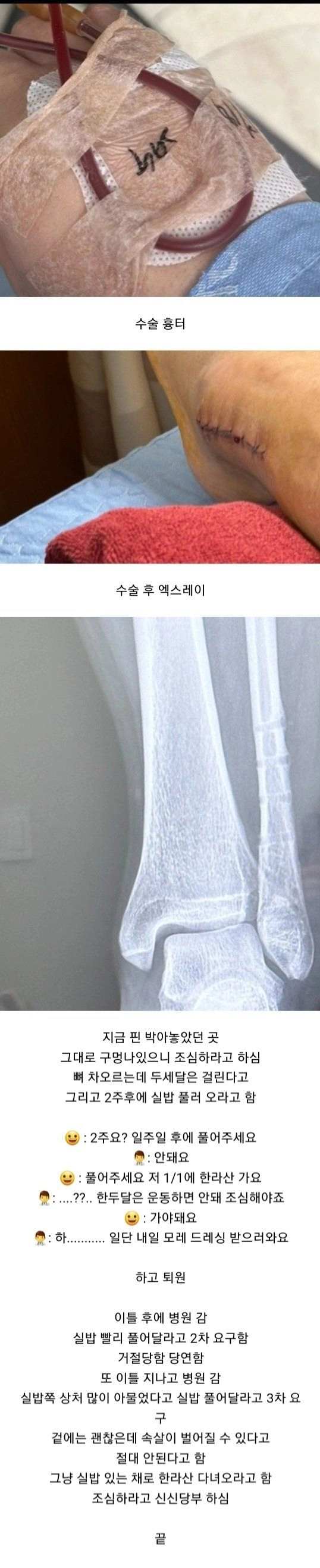 Internet_20231228_235854_5.jpeg 발목 부러졌는데 하나도 안아프다는 여자의 11개월 뒤 근황 ㄷㄷㄷ.JPG