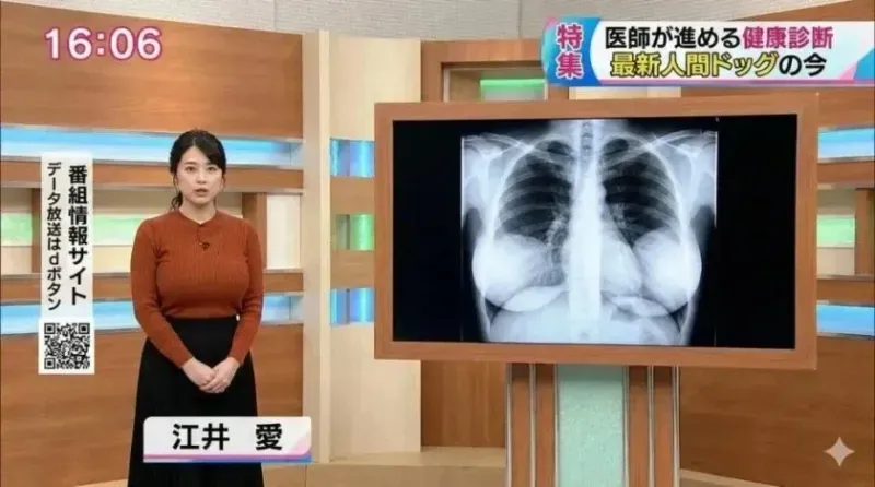 일본 여자 아나운서 흉부 엑스레이_1.webp