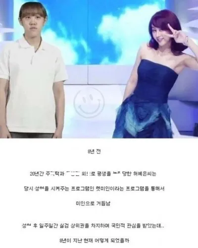렛미인 레전드 성형 8년후 현재 근황