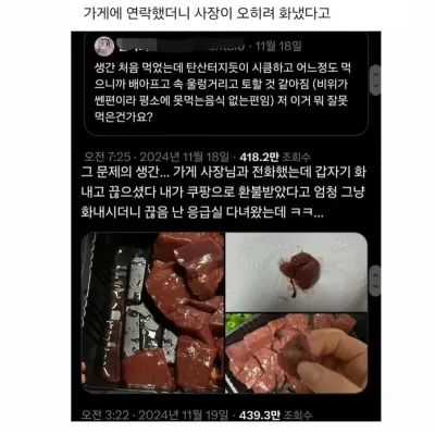 배달 생간 먹고 응급실 간 사람